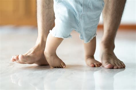 pigeon toes in early childhood.